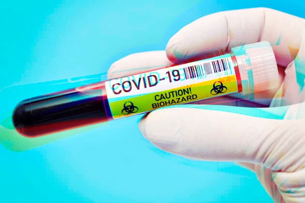 Hand with latex glove holding blood collection tubes with inscription Covid 19, symbol photo Coronavirus ** NUR FUER REDAKTIONELLE ZWECKE ** EDITORIAL USE ONLY **