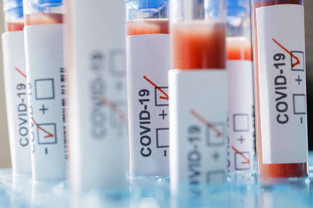 Presented picture Symbol photo Coronavirus diagnosis COVID 19, SARS CoV 2 Berlin, 05 03 2020 Berlin Germany Copyright: xThomasxTrutschel photothek.dex