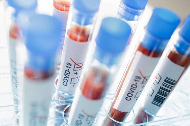 Presented picture Symbol photo Coronavirus diagnosis COVID 19, SARS CoV 2 Berlin, 05 03 2020 Berlin Germany Copyright: xThomasxTrutschel photothek.dex