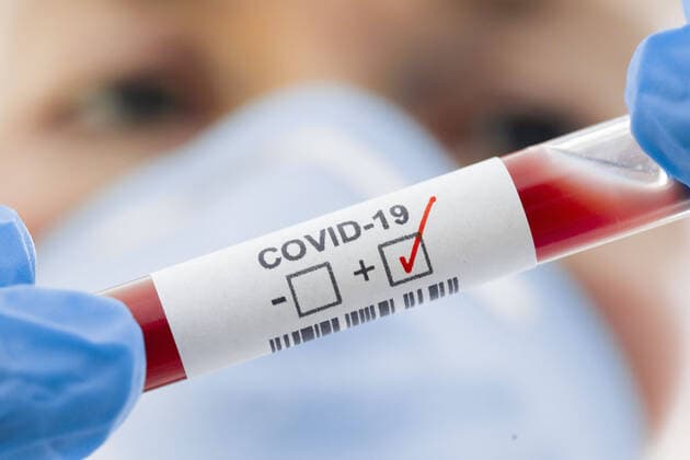 Presented picture Symbol photo Coronavirus diagnosis COVID 19, SARS CoV 2 Berlin, 05 03 2020 Berlin Germany Copyright: xThomasxTrutschel photothek.dex