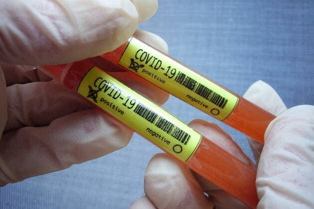 SYMBOLFOTO In the meantime, cases of infection with the new coronavirus Covid 19 SARS CoV 2 have been confirmed in almost all federal states Test, ampoules, blood test, corona test