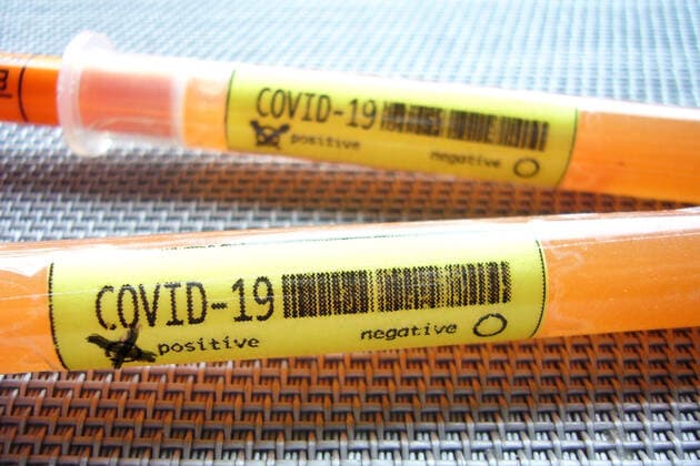 SYMBOLFOTO In the meantime, cases of infection with the new coronavirus Covid 19 SARS CoV 2 have been confirmed in almost all federal states Test, ampoules, blood test, corona test
