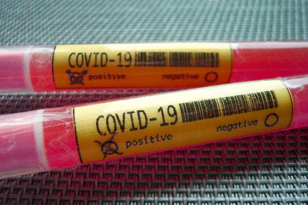 SYMBOLFOTO alienated In the meantime, cases of infection with the new coronavirus Covid 19 SARS CoV 2 have been confirmed in almost all German states Test,ampoules,blood test,corona test