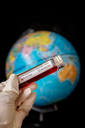Spread of coronavirus SARS CoV 2 to the world Foto:xD.xAnoraganingrumx xFuturexImage