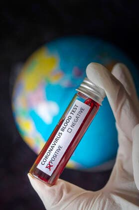 Spread of coronavirus SARS CoV 2 to the world Foto:xD.xAnoraganingrumx xFuturexImage