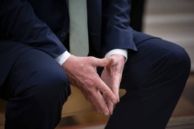 The hands of U.S. President Donald Trump during a meeting with Leo Varadkar, Ireland s prime minister, in the Oval Office of the White House in Washington, D.C. on Thursday, March 12, 2020.  WAX20200312221 ALxDRAGO