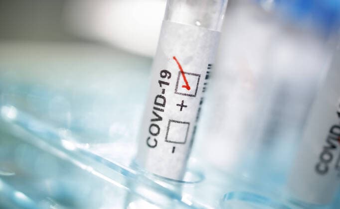 Presented picture Symbol photo Coronavirus Diagnosis COVID 19, SARS CoV 2 Berlin 17 03 2020 Berlin Germany Copyright: xThomasxImo photothek.netx