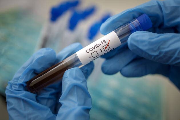 Presented picture Symbol photo Coronavirus Diagnosis COVID 19, SARS CoV 2 Berlin 17 03 2020 Berlin Germany Copyright: xThomasxImo photothek.netx