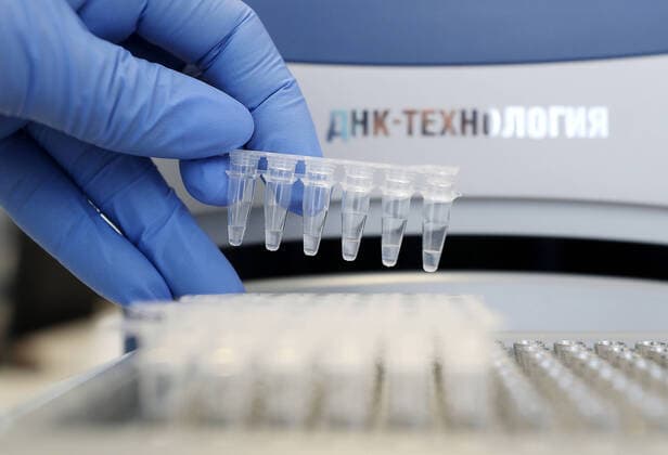 ULYANOVSK, RUSSIA - MARCH 20, 2020: Samples at the TestGene company developing and manufacturing molecular genetics test kits. Yegor Aleyev TASS  TS0D2E22