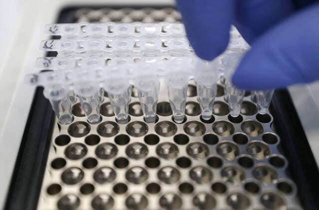 ULYANOVSK, RUSSIA - MARCH 20, 2020: Samples at the TestGene company developing and manufacturing molecular genetics test kits. Yegor Aleyev TASS  TS0D2E23