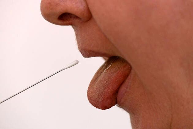 22 03 2020, tongue swabbing test with test strips in a female volunteer 22 03 2020, tongue swabbing test 22 03 2020, tongue swabbing test