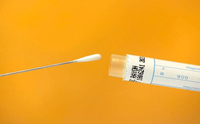 22 03 2020, Swab test for a tongue swab with test sticks 22 03 2020, Swab test 22 03 2020, Swab test