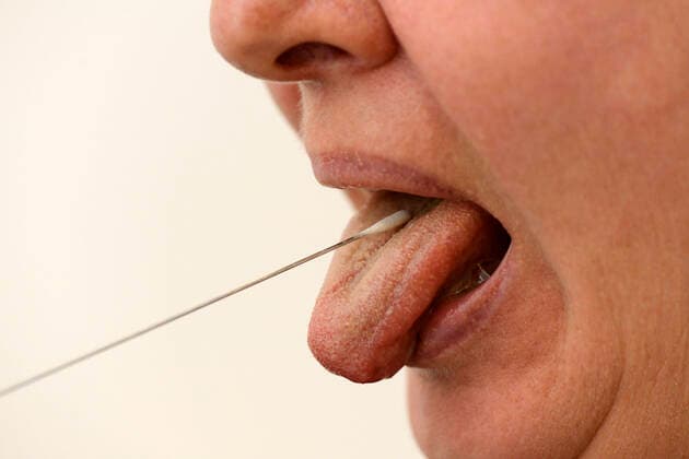 22 03 2020, tongue swabbing test with test strips in a female volunteer 22 03 2020, tongue swabbing test 22 03 2020, tongue swabbing test