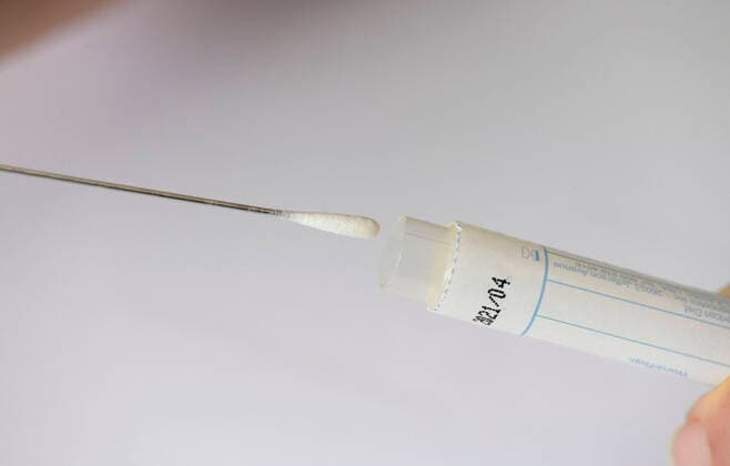 22 03 2020, Swab test for a tongue swab with test sticks 22 03 2020, Swab test 22 03 2020, Swab test
