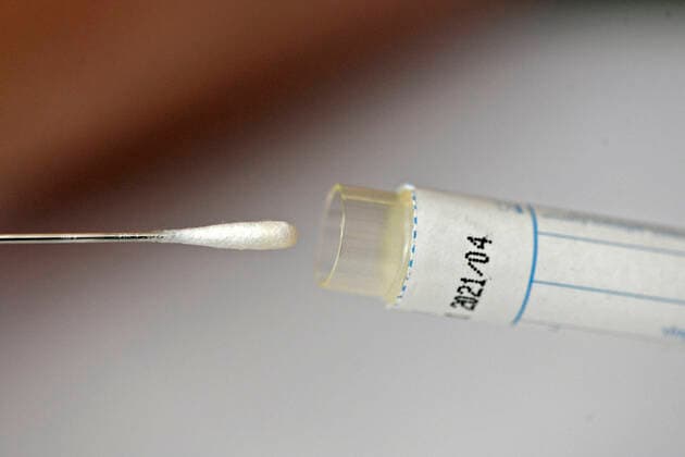 22 03 2020, Swab test for a tongue swab with test sticks 22 03 2020, Swab test 22 03 2020, Swab test