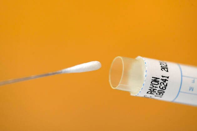 22 03 2020, Swab test for a tongue swab with test sticks 22 03 2020, Swab test 22 03 2020, Swab test