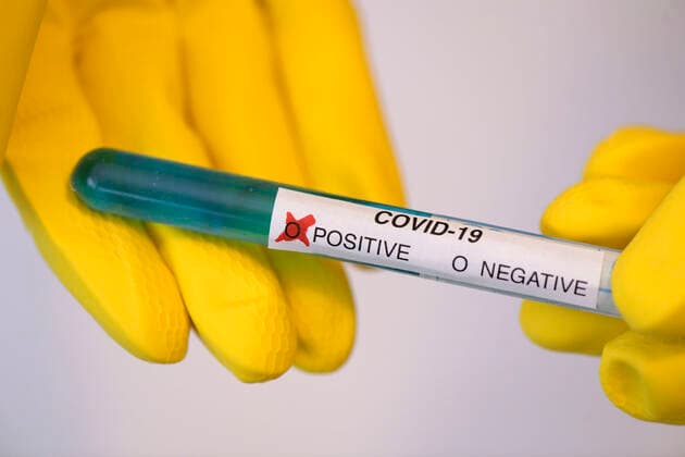 22 03 2020, Symbol image Corona Test, Positive test result 22 03 2020, Symbol image Corona Test 22 03 2020, Symbol image Corona Test