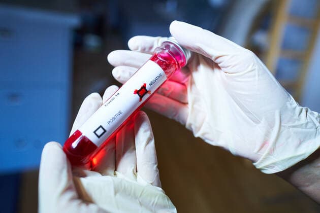 Pfaffenhofen, Germany, March 30, 2020. Corona test negative due to the Corona virus disease (COVID-19) on March 30, 2020 in Pfaffenhofen, Germany MODEL RELEASED