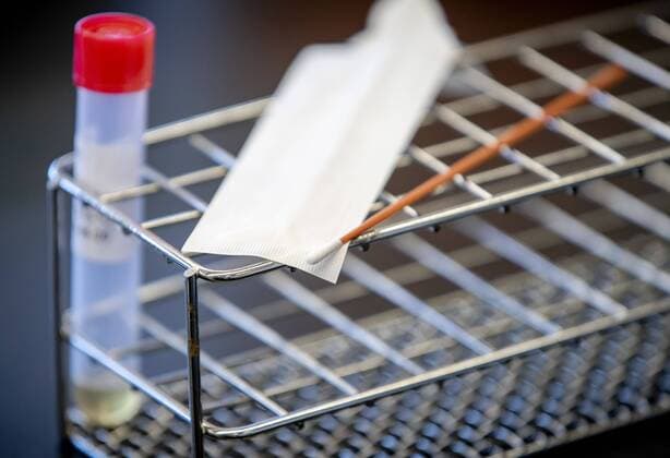 News Bilder des Tages 2020-03-31 14:40:04 ROOSENDAAL - Materiaal om te testen op infectieziekten ligt uitgestald in het laboratorium van Microvida in het Bravis ziekenhuis. In het laboratorium wordt getest op het coronavirus. ANP SEM VAN DER WAL  Copyright: xANPxSEMxVANxDERxWALx x409165444x