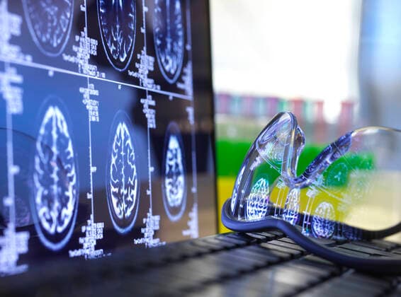 Brain scan results reflecting in protective glasses lying on laptop keyboard  ABRF00704