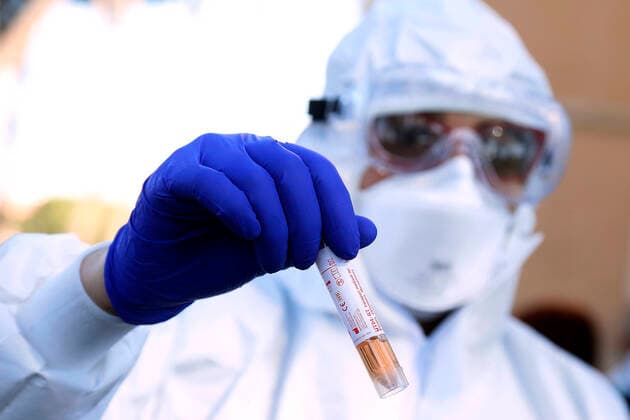 Rome April 4th 2020. Santa Maria della Pieta . Coronavirus emergency. Due to the spread of Covid-19 virus, Italy started a new procedure, a drive-through COVID-19 pharyngeal and nasal swab to test possible positivity to the infection . In the pictures, medical workers testing doctors and nurses of San Filippo Neri hospital. Photo Samantha Zucchi Insidefoto SamanthaxZucchi