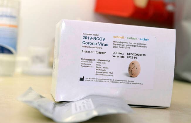 22 04 2020, COVID 19 Antibody Test Kit, Corona Virus Rapid Test is a rapid chromatographic immunoassay for the qualitative detection of IgG and IgM antibodies to SARS CoV 2 in human whole blood, serum or plasma as an aid in the diagnosis of primary and secondary SARS CoV 2 infections 22 04 2020, Corona Virus Antibody Test 22 04 2020, Corona Virus Antibody Test
