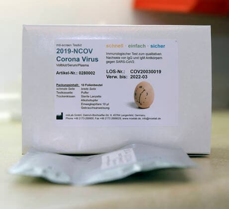22 04 2020, COVID 19 Antibody Test Kit, Corona Virus Rapid Test is a rapid chromatographic immunoassay for the qualitative detection of IgG and IgM antibodies to SARS CoV 2 in human whole blood, serum or plasma as an aid in the diagnosis of primary and secondary SARS CoV 2 infections 22 04 2020, Corona Virus Antibody Test 22 04 2020, Corona Virus Antibody Test