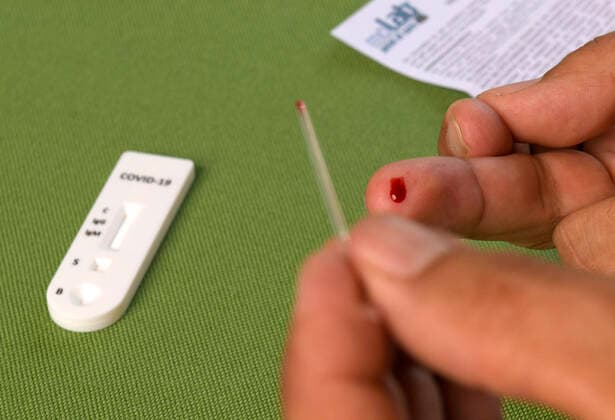 23 04 2020, A man uses the COVID 19 antibody test kit for self-testing in the home at the kitchen table, using the sterile disposable capillary to suck the drop of blood from his midd