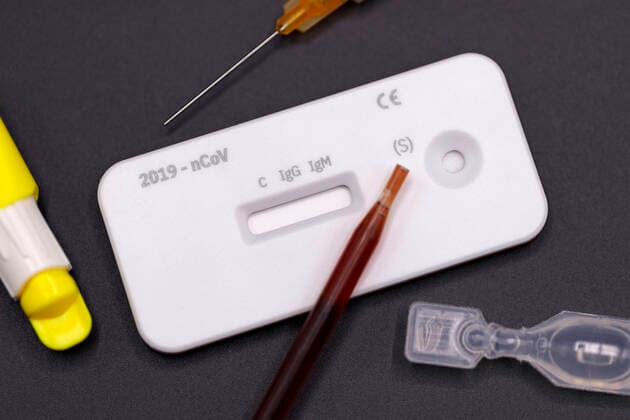Corona Test or Cleartest for Corona from servoprax for the qualitative detection of IgG and IgM antibodies against 2019 nCov in human whole blood samples from the fingertip Foto:xC.xHardtx xFuturexImage