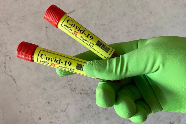 SYMBOL PHOTO,THEME PICTURE CORONAVIRUS PANDEMIA Test,Ampoules,Blood Test,Corona Test Ampoule,Tubes in hands protected with protective gloves