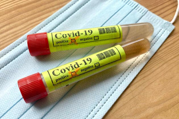 SYMBOL PHOTO,THEME PICTURE CORONAVIRUS PANDEMIA TEST,ampoules,blood test,corona test ampoule,tubes lying on a mouth nose shield,mouth guard,mask,