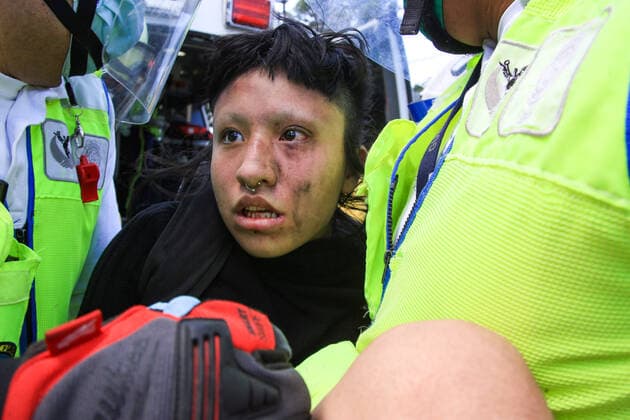 An injured protester ,15, is treated by paramedics outside of Casa Jalisco after confront officers during riots in response over the police killing of Giovanni Lopez, 30, Thousand of protesters gathered demanding justice for Giovanni after he died in police custody on June 5, 2020 In Mexico City, Mexico. Where: Mexico City, Mexico When: 05 Jun 2020 Credit: Eyepix Cover Images **EDITORIAL USE ONLY** Copyright: xOwenxGranadosx 40547687 EDITORIAL USE ONLY. NOT FOR USE BY NEWSPAPERS BASED IN THE UK.