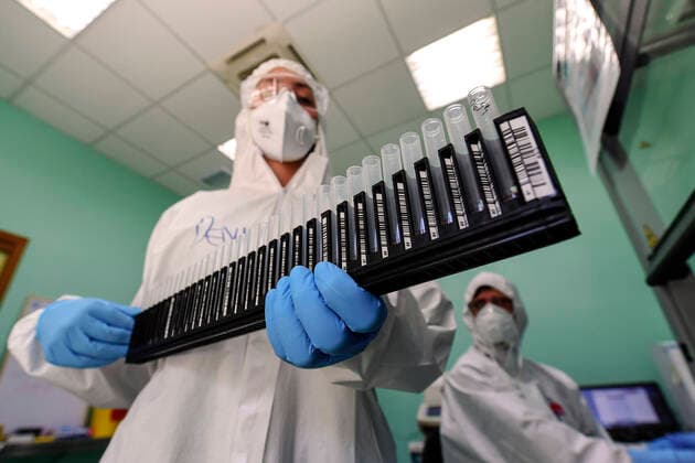 A medical technician works in the laboratory of the Infectious diseases department for coronavirus (COVID-19) handling samples of coronavirus COVID 19 tests at the microbiology laboratory of Naples.  Copyright: xSalvatorexLaportax xIPAx xKontrolabx