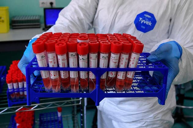 A medical technician works in the laboratory of the Infectious diseases department for coronavirus (COVID-19) handling samples of coronavirus COVID 19 tests at the microbiology laboratory of Naples.  Copyright: xSalvatorexLaportax xIPAx xKontrolabx