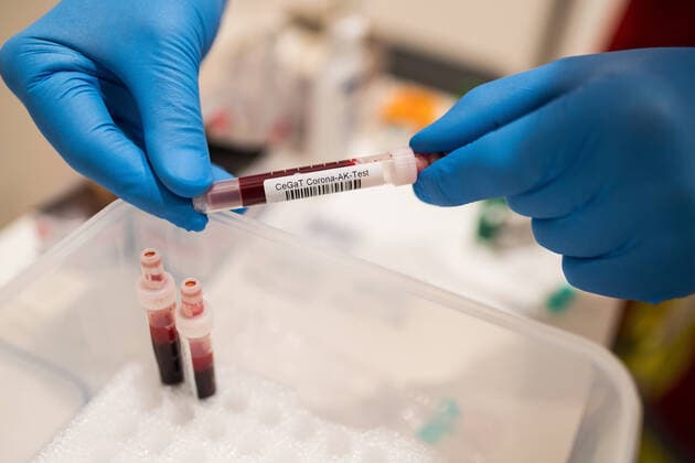 Corona antibody test 15 06 2020 Frankfurt x1x Corona antibody test for everyone in the Intercity Hotel must not be mentioned In the picture Test tubes filled with blood Frankfurt Frankfurt Hessen Germany