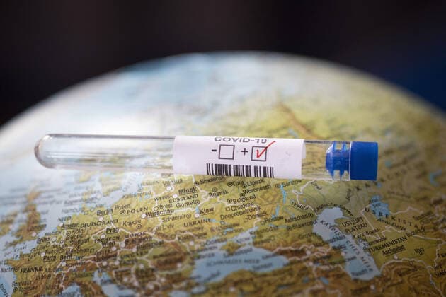 Subject Vaccine development Test tubes labelled COVID 19 Bonn Germany Copyright: xUtexGrabowsky photothek.netx