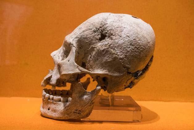 IMAGO Cultures of the world, Zapotec Kultur in Mexiko A skull from the ruins of Monte Alban showing cranial deformation and trepanation surgery. Monte Alban Site Museum, Oaxaca, Mexico. A UNESCO World Heritage Site. Santa Cruz Xoxocotlan Monte Alban Archeological Zone Oaxaca Mexico Copyright: xJonxG.xFullerx JGF-museum-Monte Alban-MX-9856