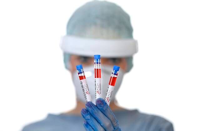 Positive test result, medical staff at RT PCR, Real time Reverse Transcriptase Polymerase Chain Reaction, Corona Test, Corona Crisis, Baden Württemberg, Germany, Europe Copyright: imageBROKER/MichaelxWeber ibximw05909127.jpg