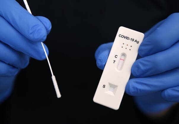 Tuebingen 03 12 2020 Symbol image Negative SARS CoV 2 Rapid Antigen Rapid test and swab ULMER