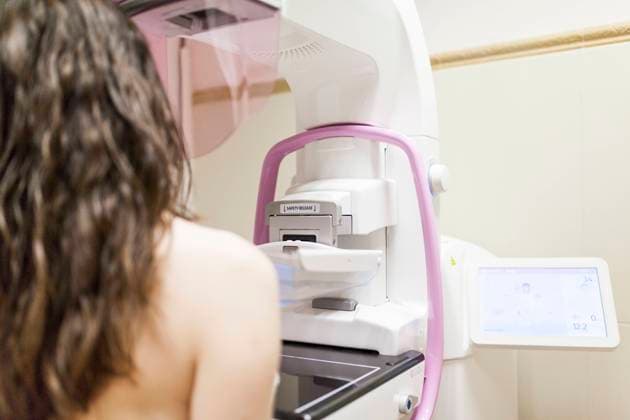IMAGO Creative: Brustkrebsmonat Female patient beside digital mammography unit, Model released Copyright: xDavidxFuentesx MR