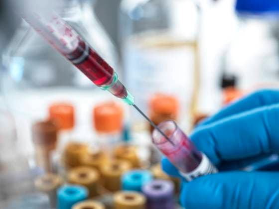 Biomedical scientist working with blood sample at laboratory model released Symbolfoto property released ABRF00790