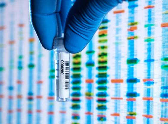 Scientists hand in latex glove holding vial containing sample with DNA results on screen in background model released Symbolfoto property released ABRF00783