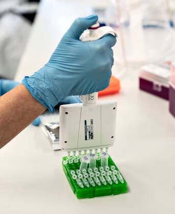 Researchers at Aalborg University are working on analyzing all positive Danish corona samples for the English virus variant cluster B 1 1 7, Friday 15 January 2021 It takes place at the Department of Chemistry and Life Sciences under the leadership of Professor Mads Albertsen and the results are sent daily to the Statens Serum Institut Here you can t  Copyright: HenningxBagger HenningxBaggerx COP103 spdk20210115-130105-L