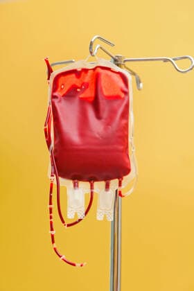 Weltblutspendetag am 14. Juni Eine Blutkonserve zur Infusion in eine Klinik. Spenderblut wird verabreicht. McPBBO *** A unit of blood for infusion into a clinic Donor blood is administered McPBBO McPBBO