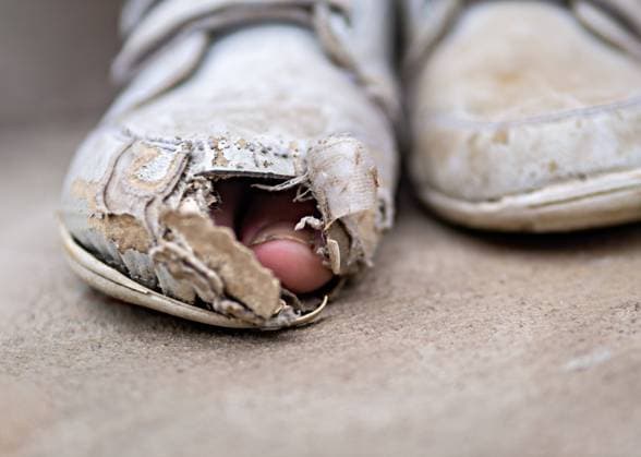 Zeh schaut aus kaputtem Sportschuh *** Toe peeking out of broken athletic shoe 1028901353