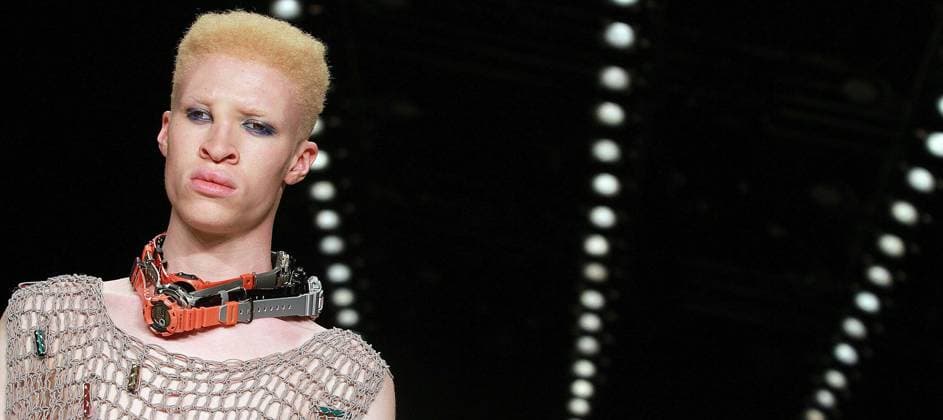 Albino Model Shaun Ross Starsyling Mercedes Benz Fashionweek Berlin Summer 2010 Bebelplatz Berlin Copyright: xEventpressxRadkex