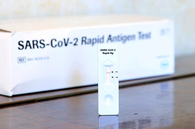 A negative SARS CoV 2 Rapid Antigen Test The Corona rapid tests are seen as the first way out of the lockdown To make free testing possible, the federal and state governments have decided that all citizens will be allowed one free rapid test per week starting Monday, March 8 Symbol image, theme image Berlin, 05 03 2021 Foto:xS.xGabschx xFuturexImage