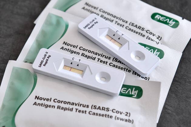 Topic Image Corona Antigen Test,Rapid Test, Corona Rapid Test Self Test Every federal citizen should be entitled to one free rapid test per week