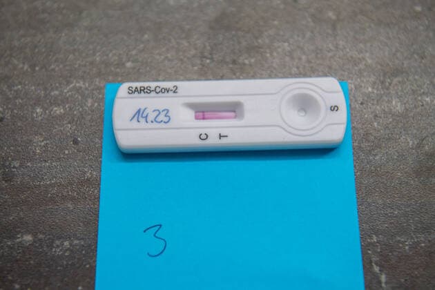 Aue, Germany 16 March 2021 A Corona rapid test used to combat the Corona pandemic Saxony Copyright: xFotostandx xDostmannx