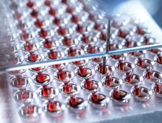 Blood samples in container at lab property released ABRF00853